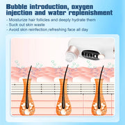 small bubble blackhead remover pore vacuum, view 6 - MRSLM
