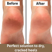 golden foot file rasp for callus removal, view 8 - MRSLM