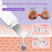Ultrasonic skin scrubber with 3 modes, view 8 - MRSLM