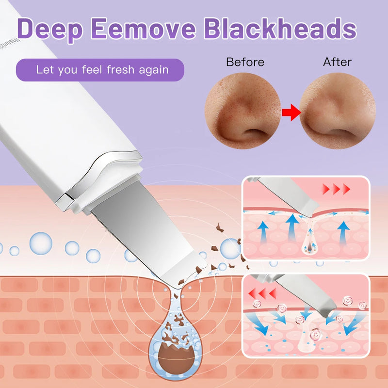 Ultrasonic skin scrubber with 3 modes, view 8 - MRSLM