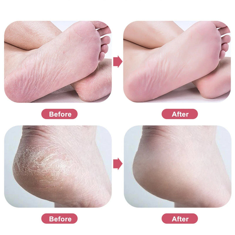 nano glass foot rasp, view 9 - MRSLM
