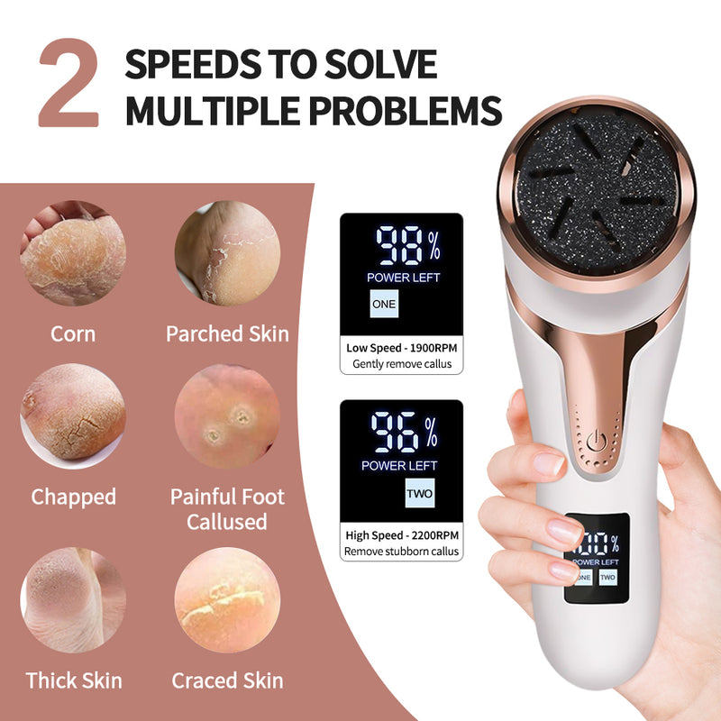 electric foot dead skin remover, view 5 - MRSLM