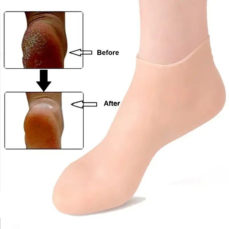 silicone spa gel socks, view 9 - MRSLM