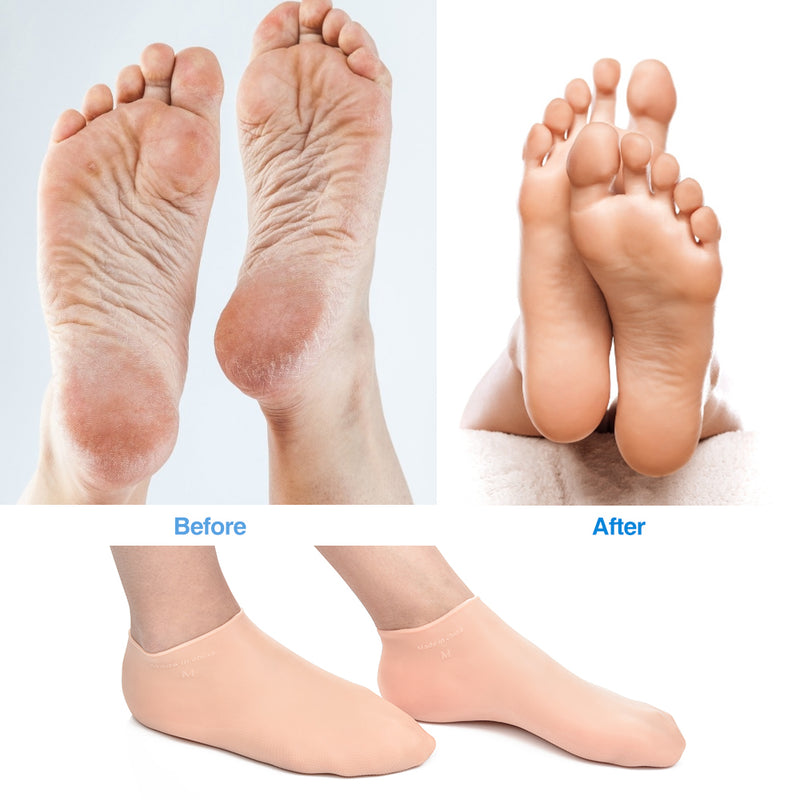 silicone gel moisturizing socks, view 5 - MRSLM