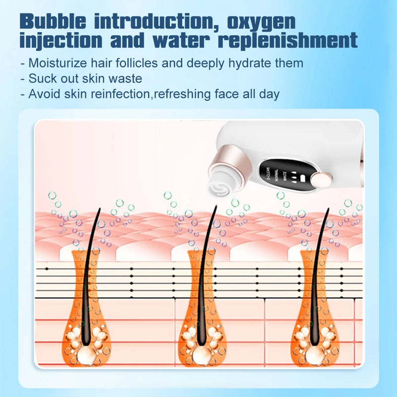 electric pore vacuum and face cleaner, view 5 - MRSLM