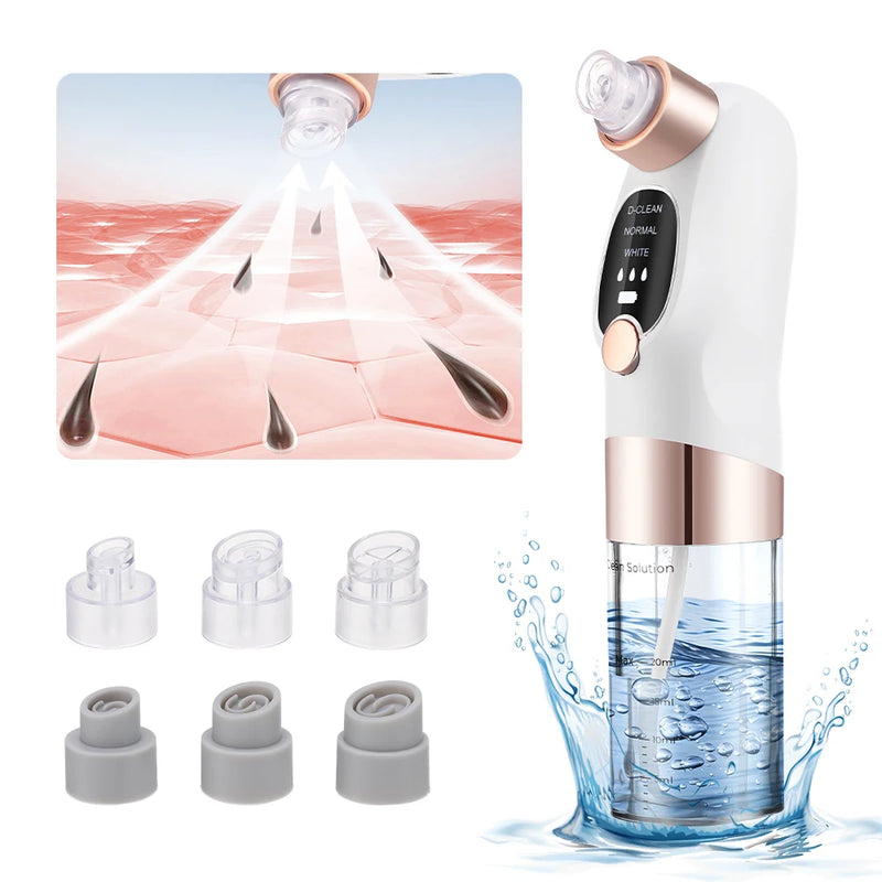 electric pore vacuum and face cleaner, view 2 - MRSLM