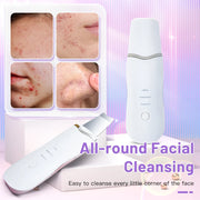Ultrasonic skin scrubber with 3 modes, view 7 - MRSLM
